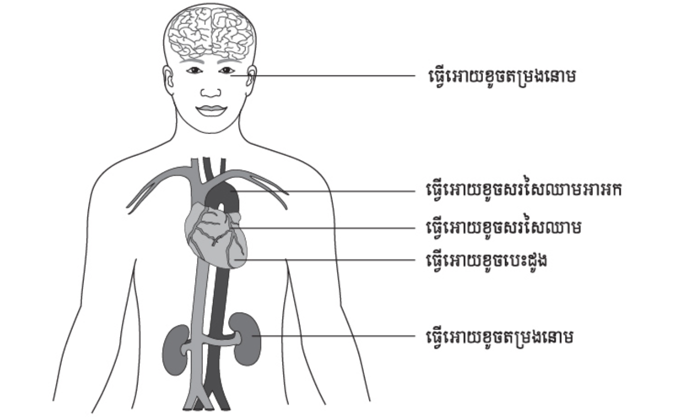 Lesbians tomosha sifati